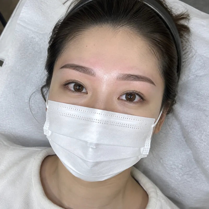 소양로 엠보눈썹 시술 예시 이미지