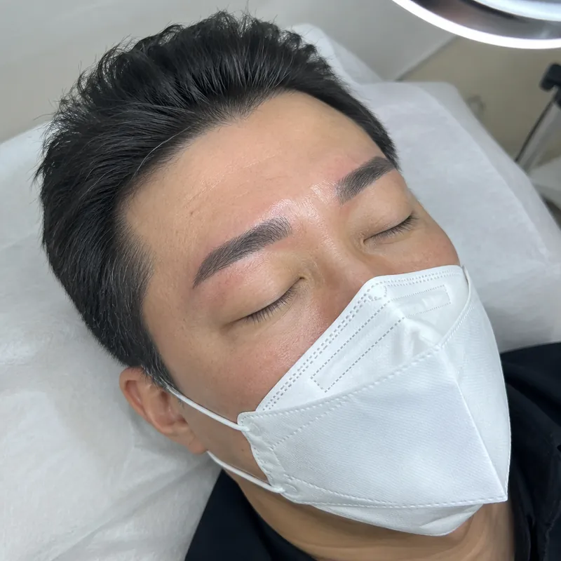 이현동 남자눈썹 시술 예시 이미지