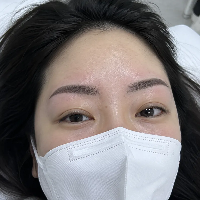 신영동 콤보눈썹 시술 예시 이미지